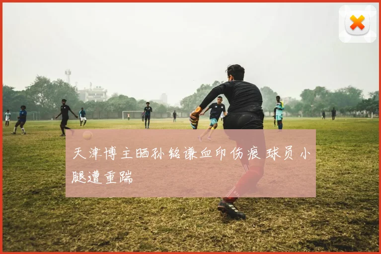 天津博主晒孙铭谦血印伤痕 球员小腿遭重踹